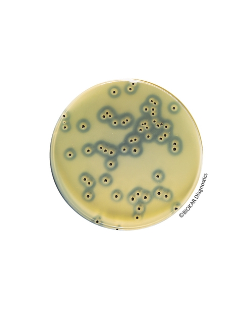 Baird-Parker Agar With Egg Yolk Tellurite