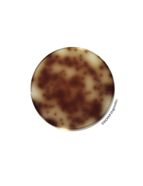 Bile Esculin Azide Agar (BEA agar)