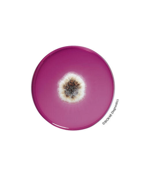 Dichloran Rose Bengal Chloramphenicol (DRBC) Agar