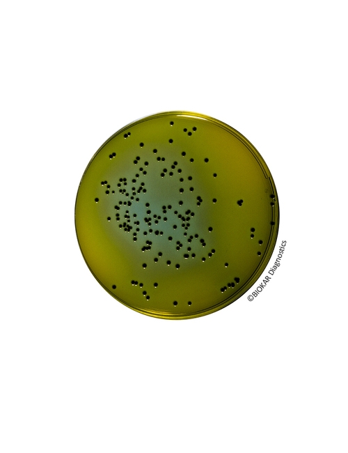 Hektöen Enteric Agar