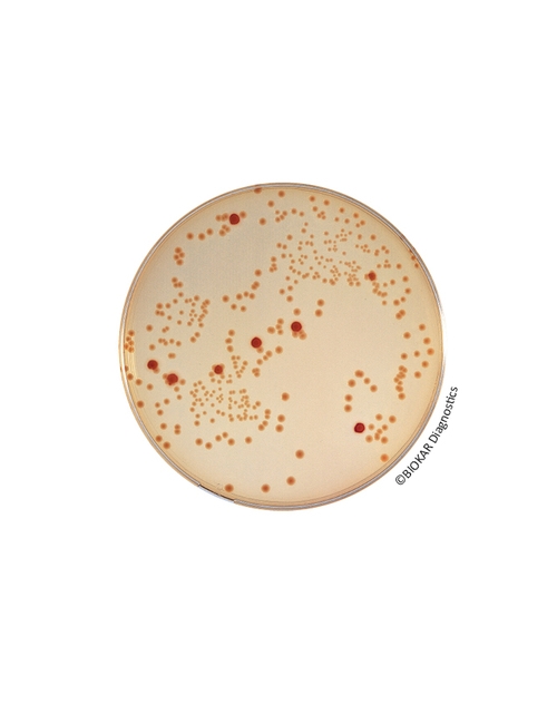 Escherichia coli O157