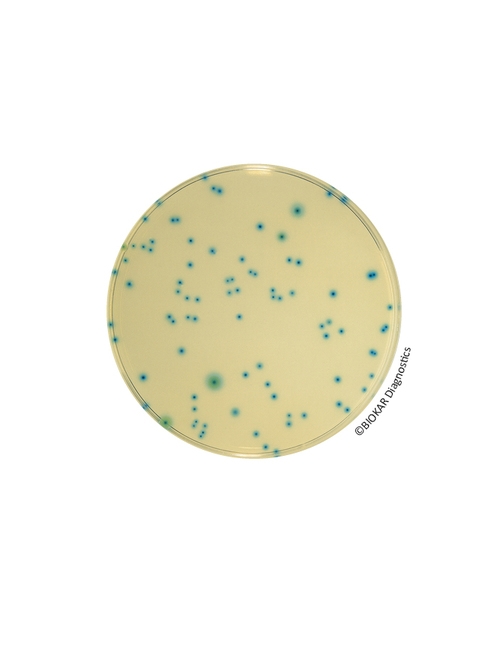 TRYPTONE-BILE-X-GLUCURONATE (TBX) AGAR