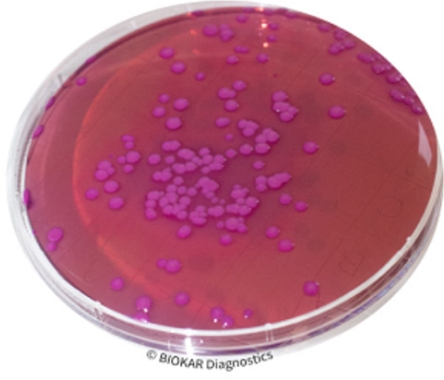 CONTACT VRBG + NEUTRALIZERS